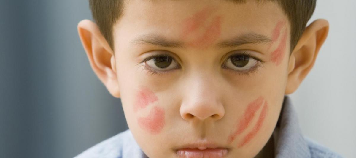 Imagen de archivo de un niño con marcas de besos.