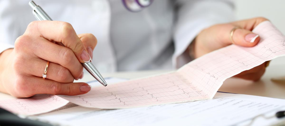 Imagen de archivo de un electrocardiograma.