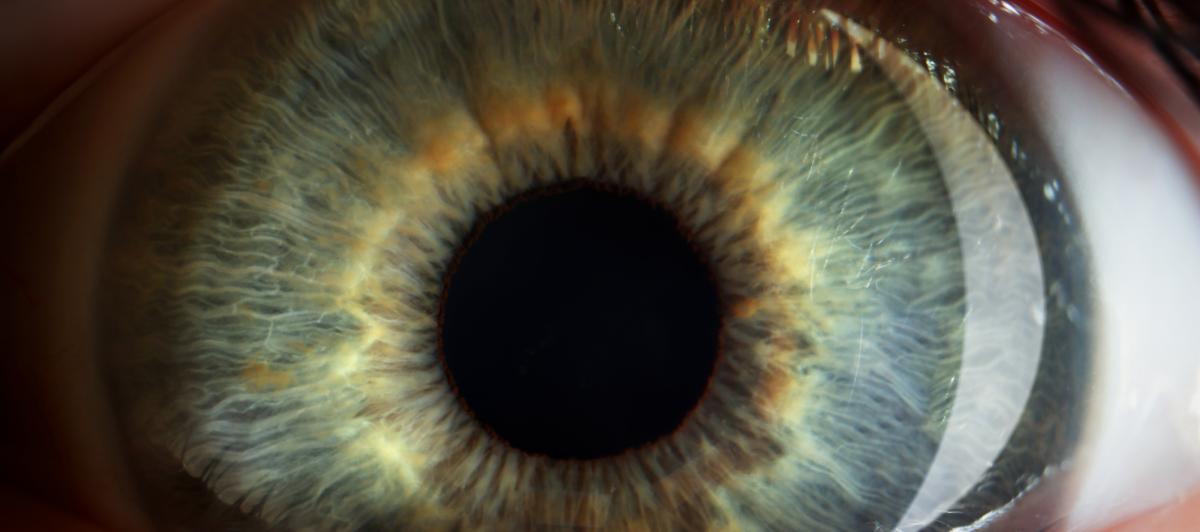 Fotografìa de archivo del iris de una persona.