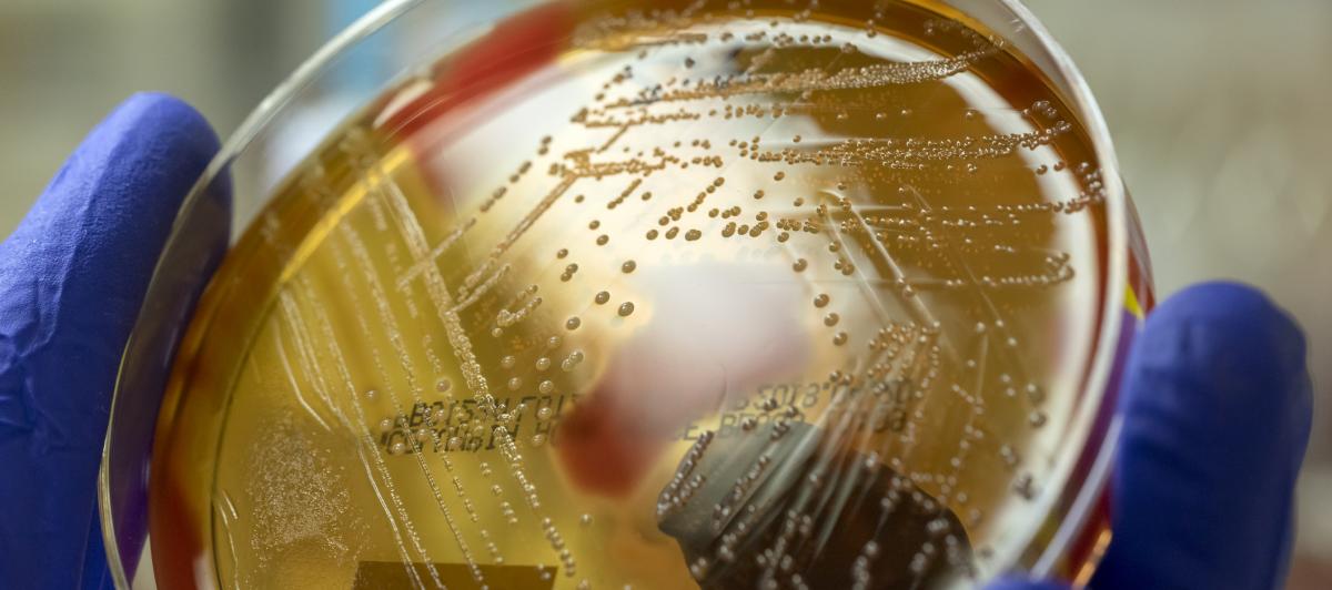 Imagen de archivo de un cultivo de Streptococcus pyogenes.
