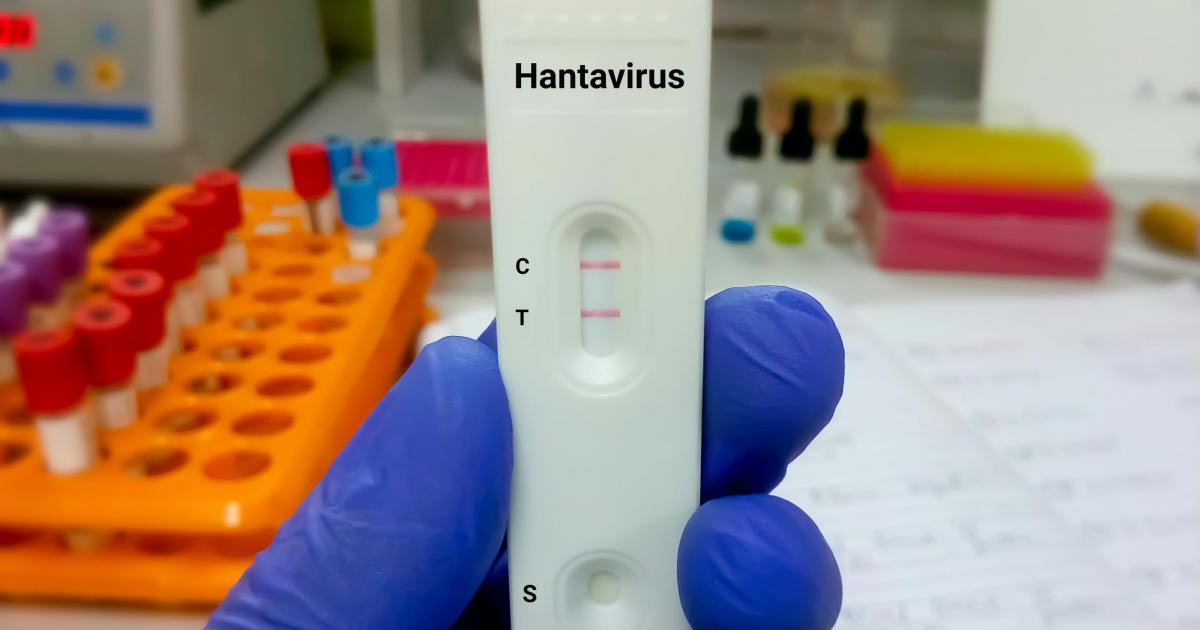 Una prueba de hantaviurs