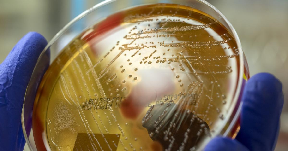 Imagen de archivo de un cultivo de Streptococcus pyogenes.