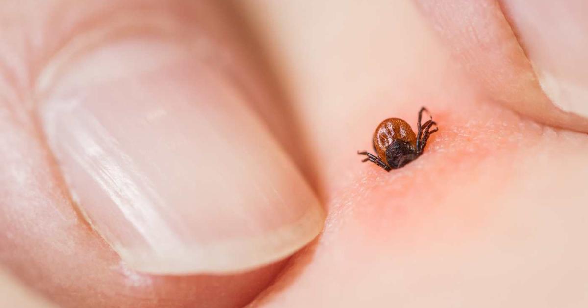 El ataque de una garrapata