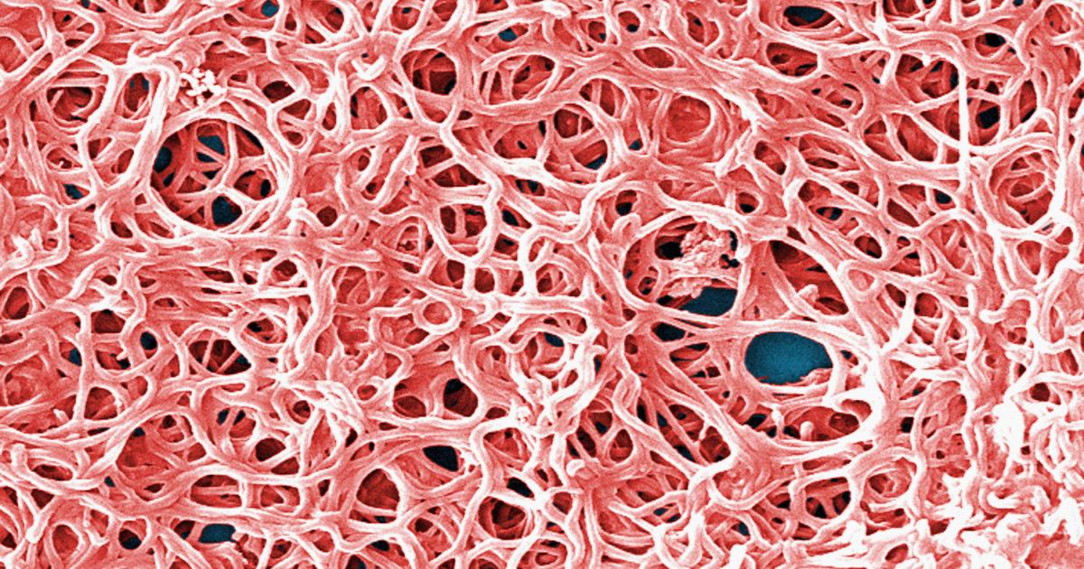 Vista microscópica de la bacteria que causa la enfermedad de Lyme y que transmiten insectos como las garrapatas.