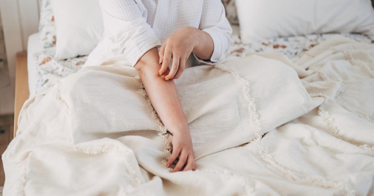 Una mujer se rasca el brazo tras una picadura de mosquito, una de las molestias más comunes del verano.