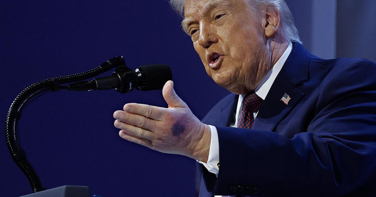 El presidente Donald Trump, con un moratón en la mano durante su intervención en el Foro de Davos en Suiza el 22 de enero de 2026.