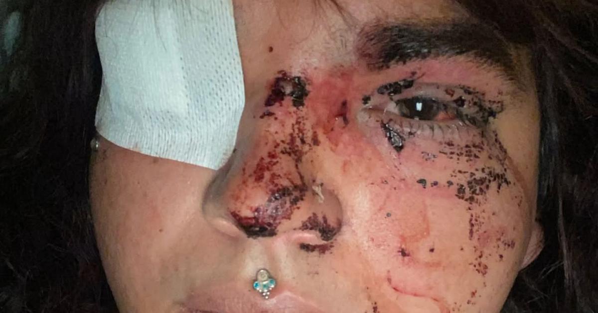 Una mujer transexual ha sufrido en La Bañeza (León) una paliza que le ha propinado supuestamente un grupo de entre ocho y diez personas, a la vez que recibía insultos homófobos y tránsfobos.