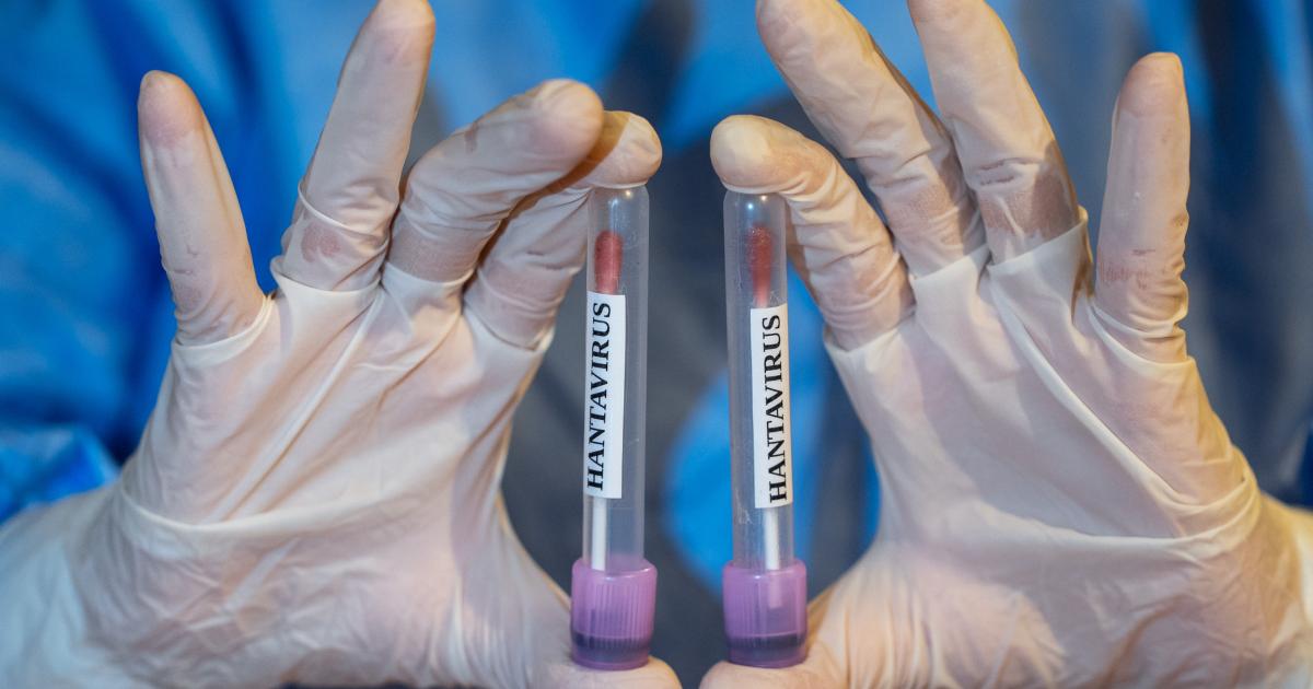 Tubos de muestras de hantavirus.