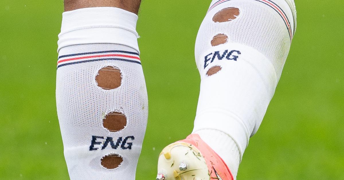 Las medias agujereadas de Jude Bellingham durante uno de los partidos del Mundial 2026
