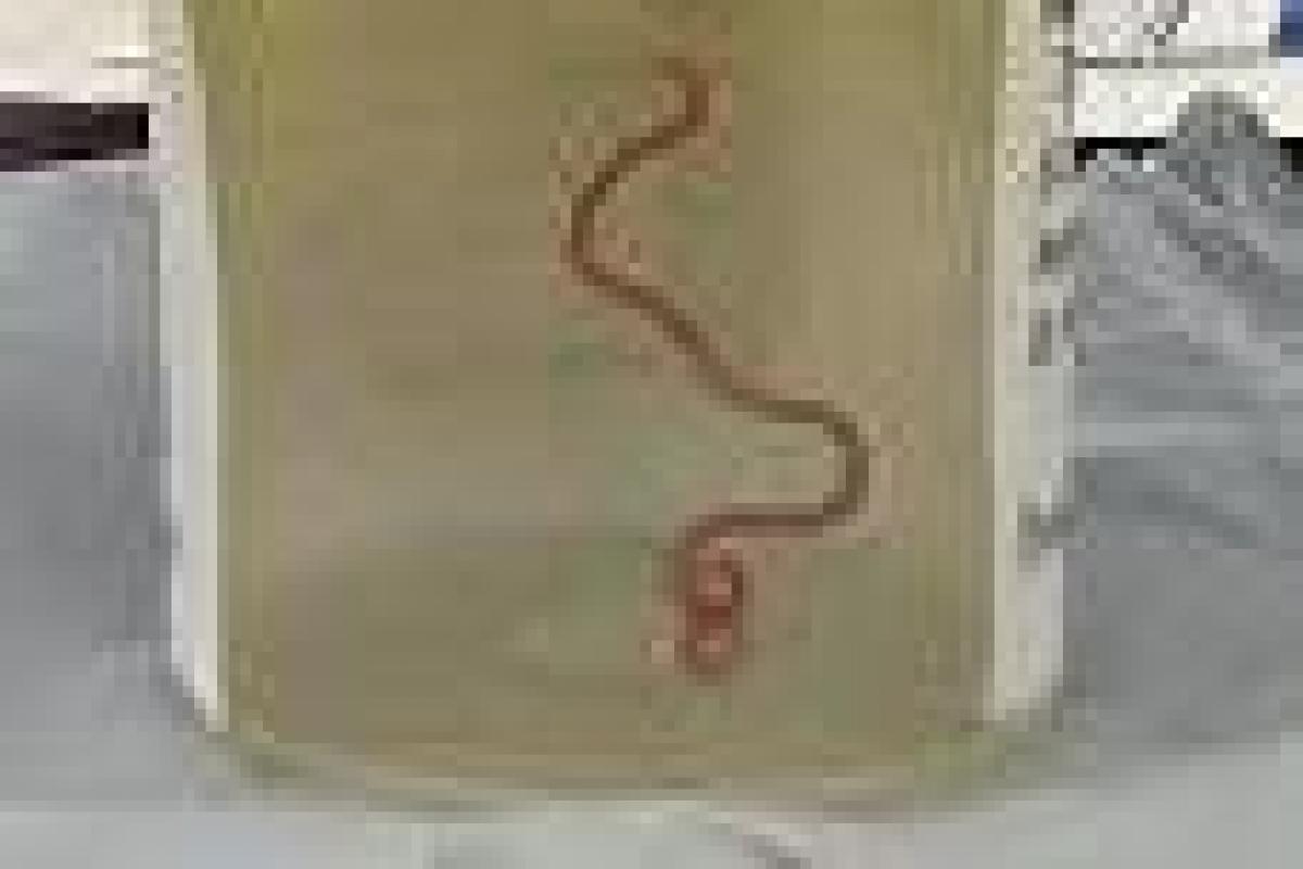 Imagen del gusano que fue extraído del cerebro de una mujer en un hospital de Canberra (Australia).