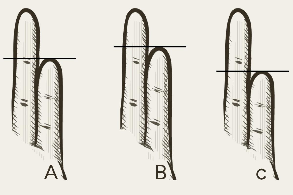 Acertijo visual de los dedos meñiques