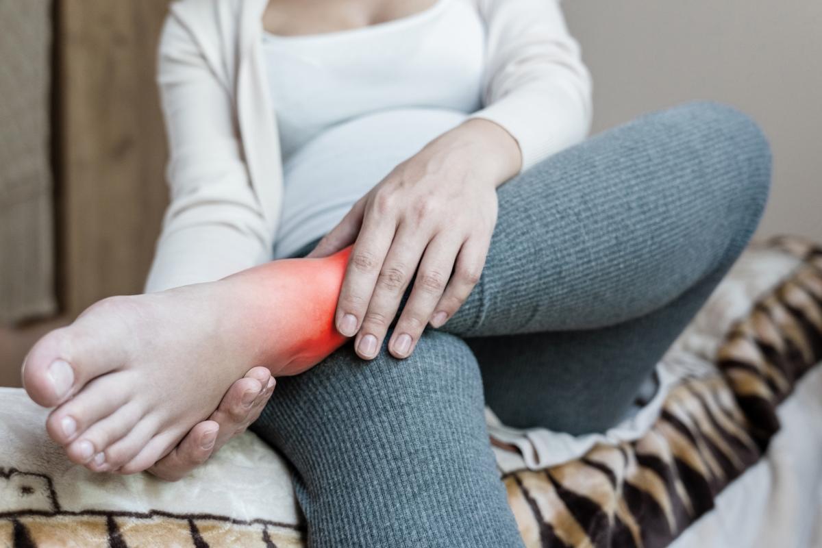 Una mujer con los tobillos hinchados.