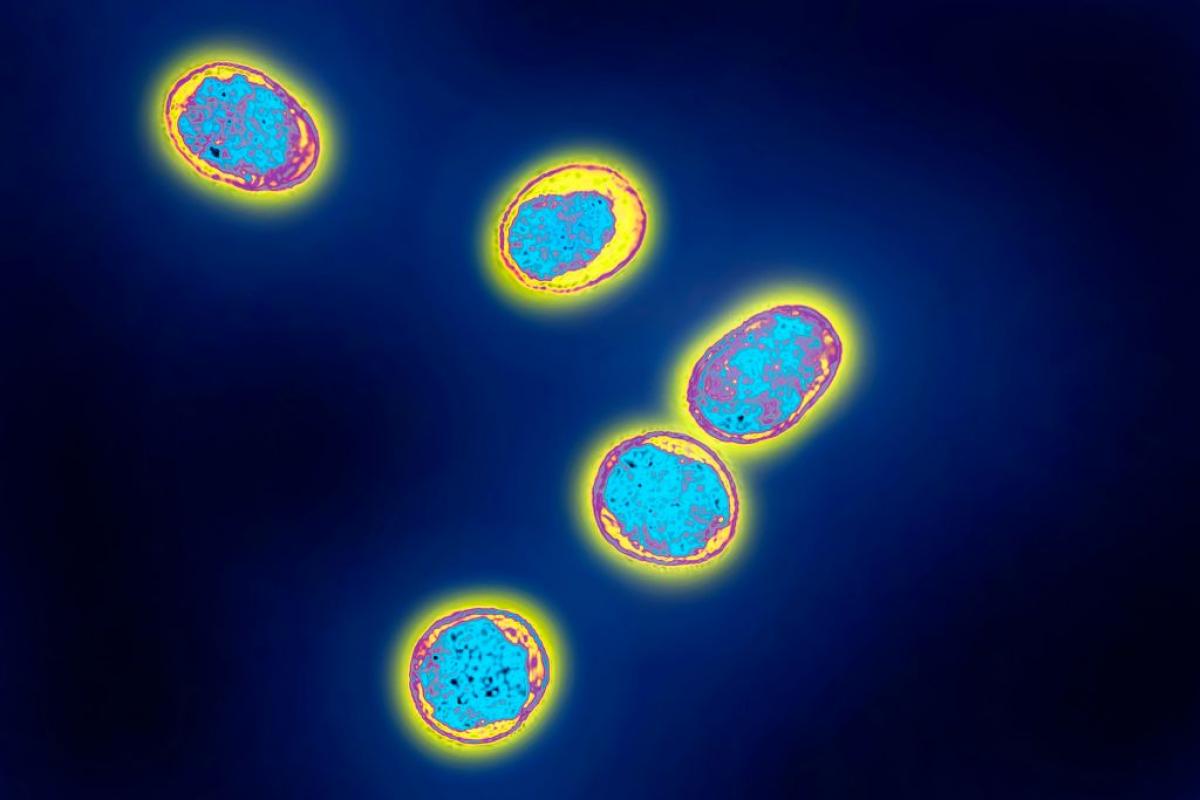 La Brucella, el género de bacterias responsable de producir la brucelosis