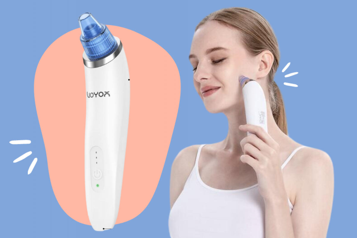 Succionador de puntos negros: el dispositivo 'top' ventas para eliminar las espinillas desde la raíz