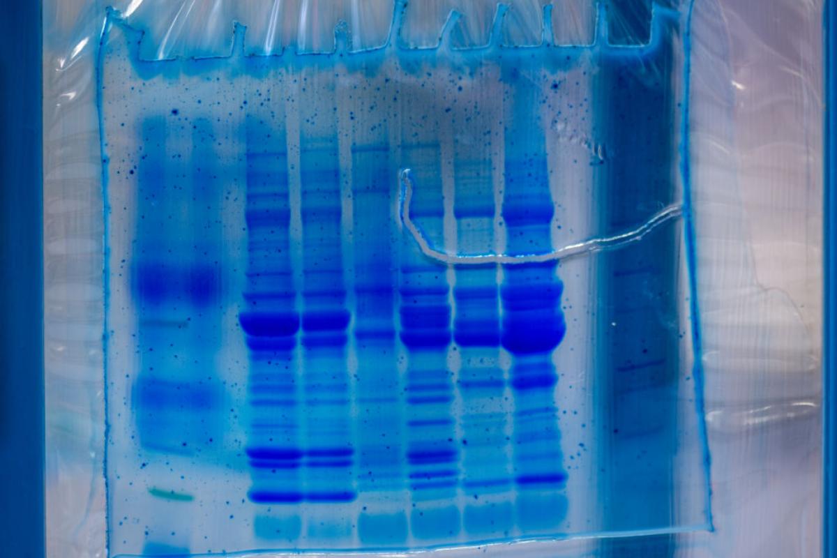 Investigadores de UC Riverside han encontrado una manera de controlar la proteína responsable del agravamiento de la mayoría de los cánceres.