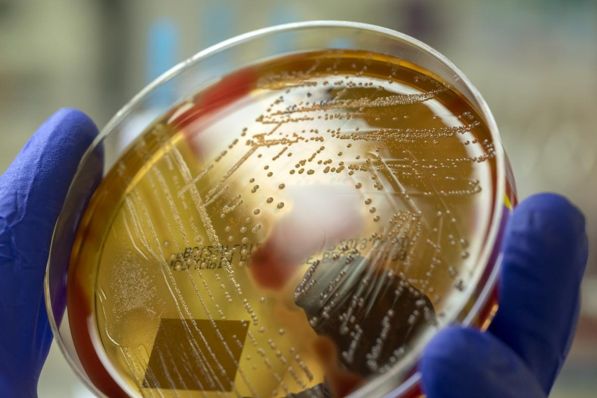 Imagen de archivo de un cultivo de Streptococcus pyogenes.