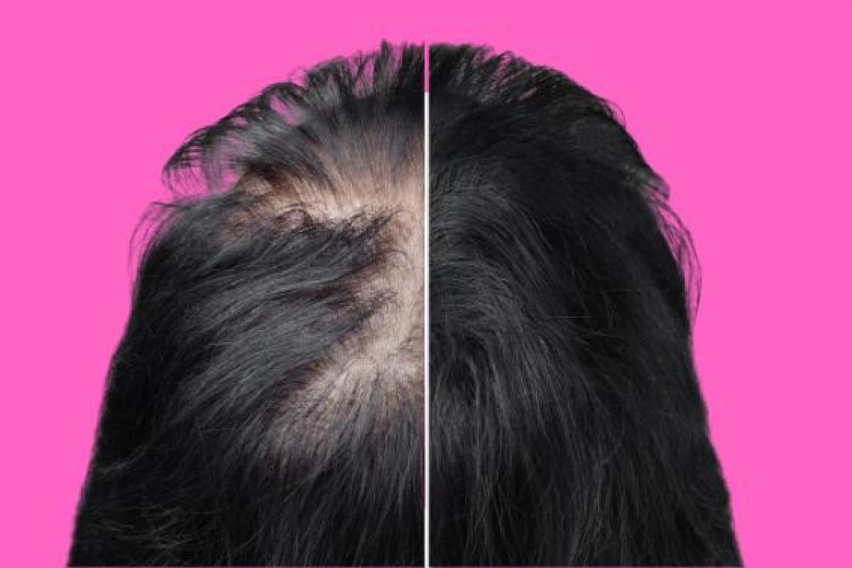 Polvo para rellenar el cabello más vendido de Amazon