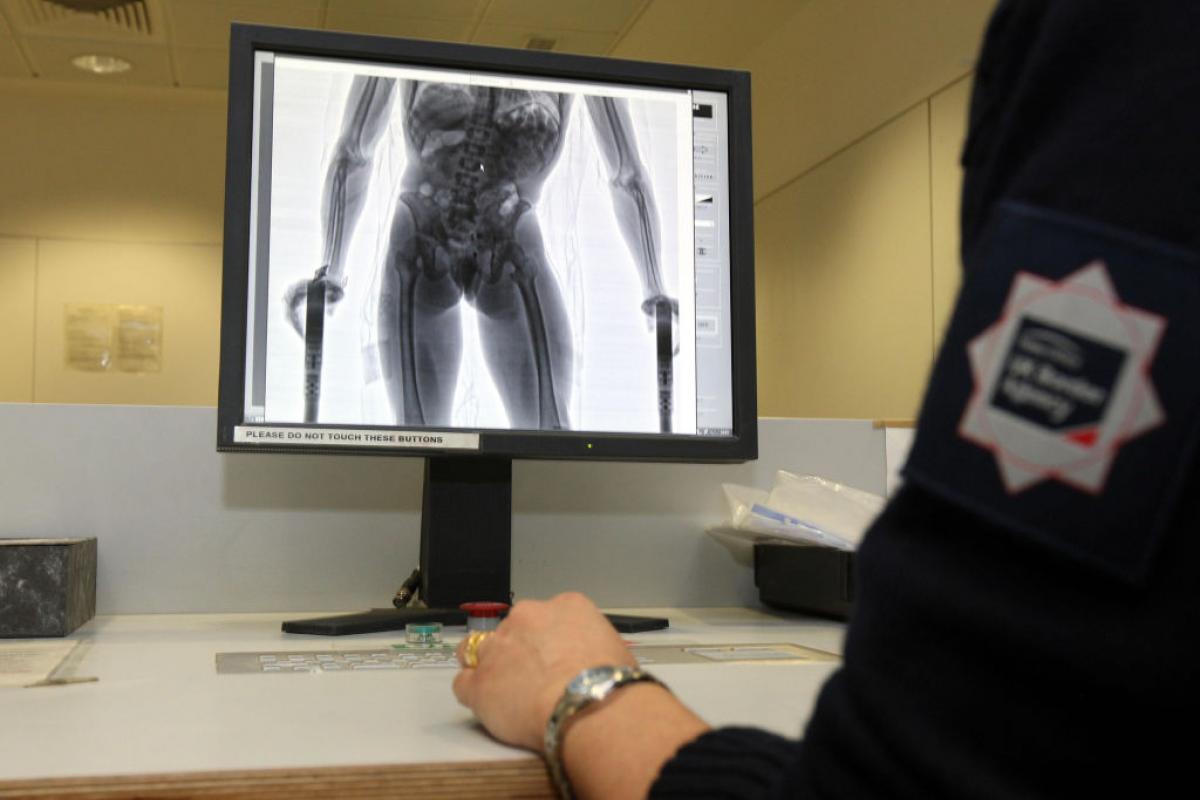 Un agente de fronteras de Reino Unido analiza la radiografía tomada a un sospechoso de haber ingerido drogas.