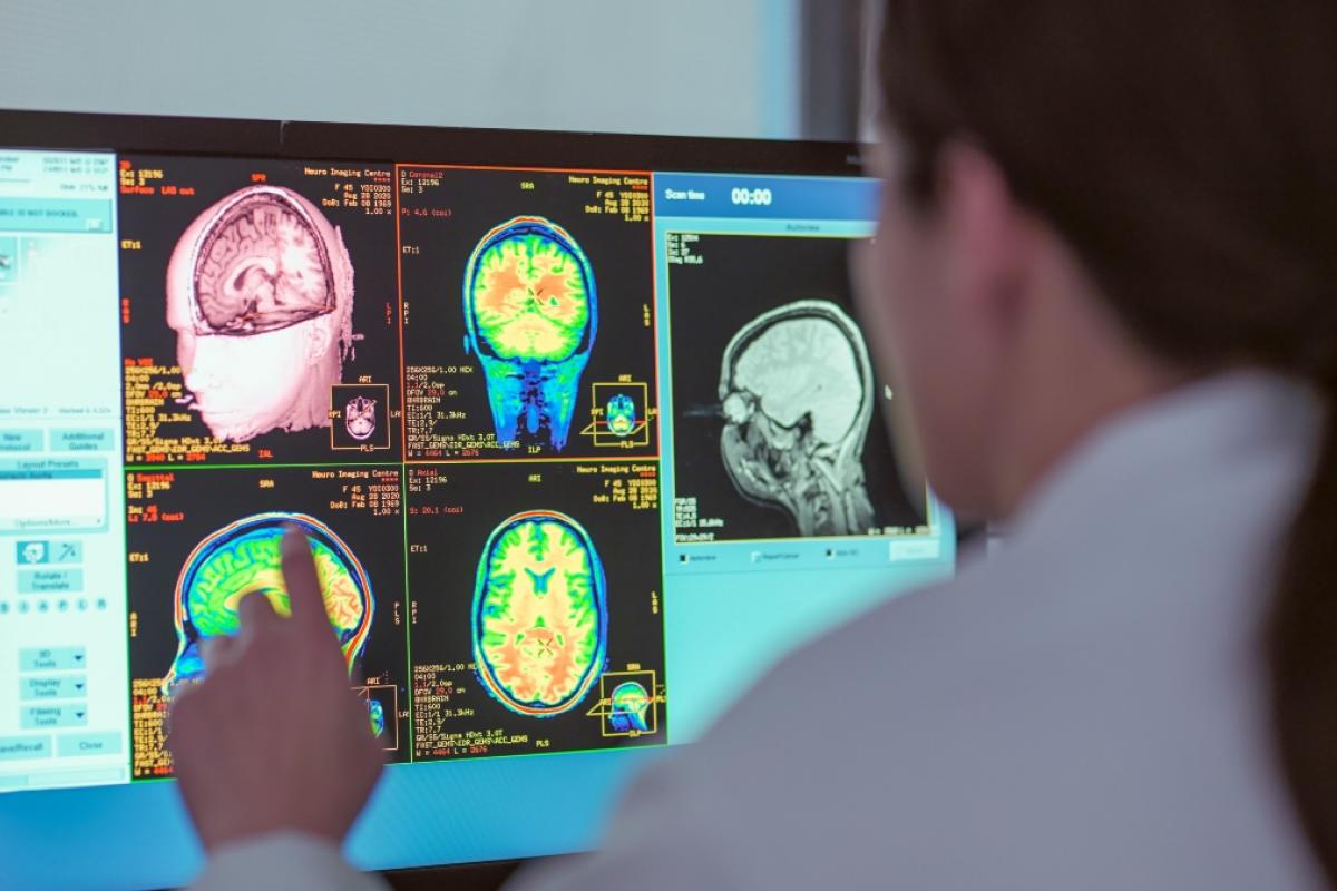 Captan "la visión más clara" de cómo las células cerebrales encarnan el pensamiento