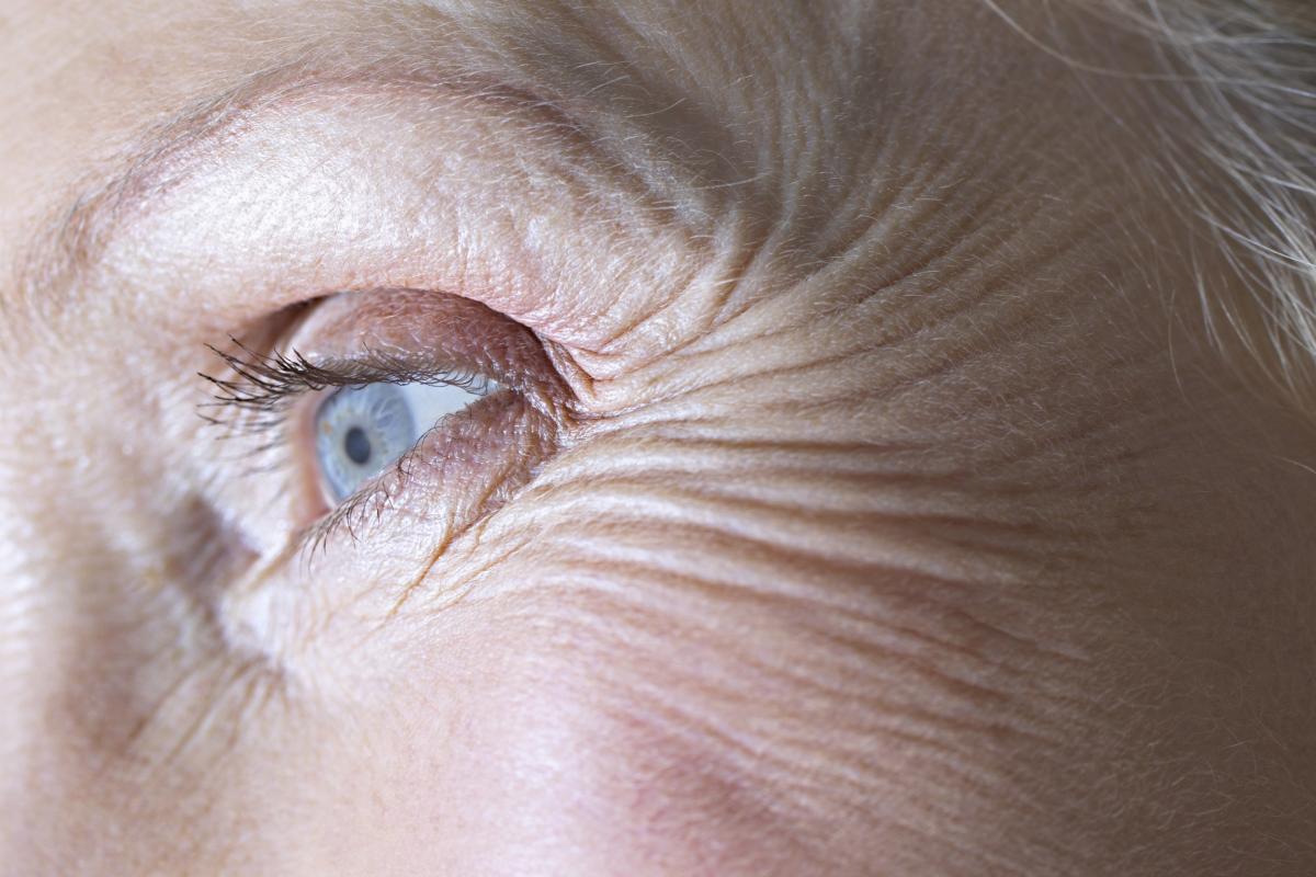 Arrugas de una mujer.