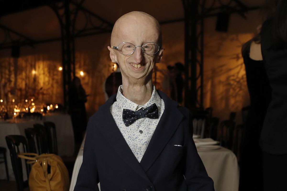 El italiano Sammy Basso, el paciente más longevo de progeria, en una imagen reciente.