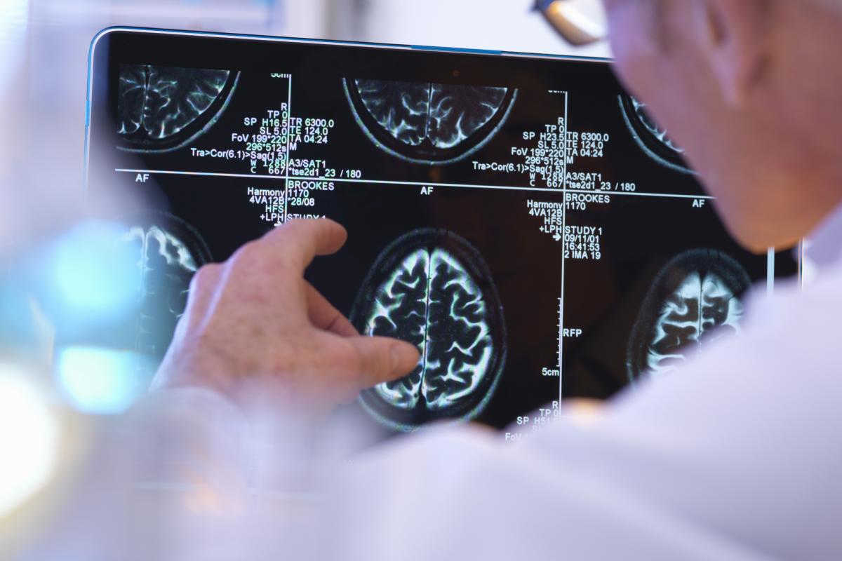 Un neurólogo revisa una prueba cerebral.