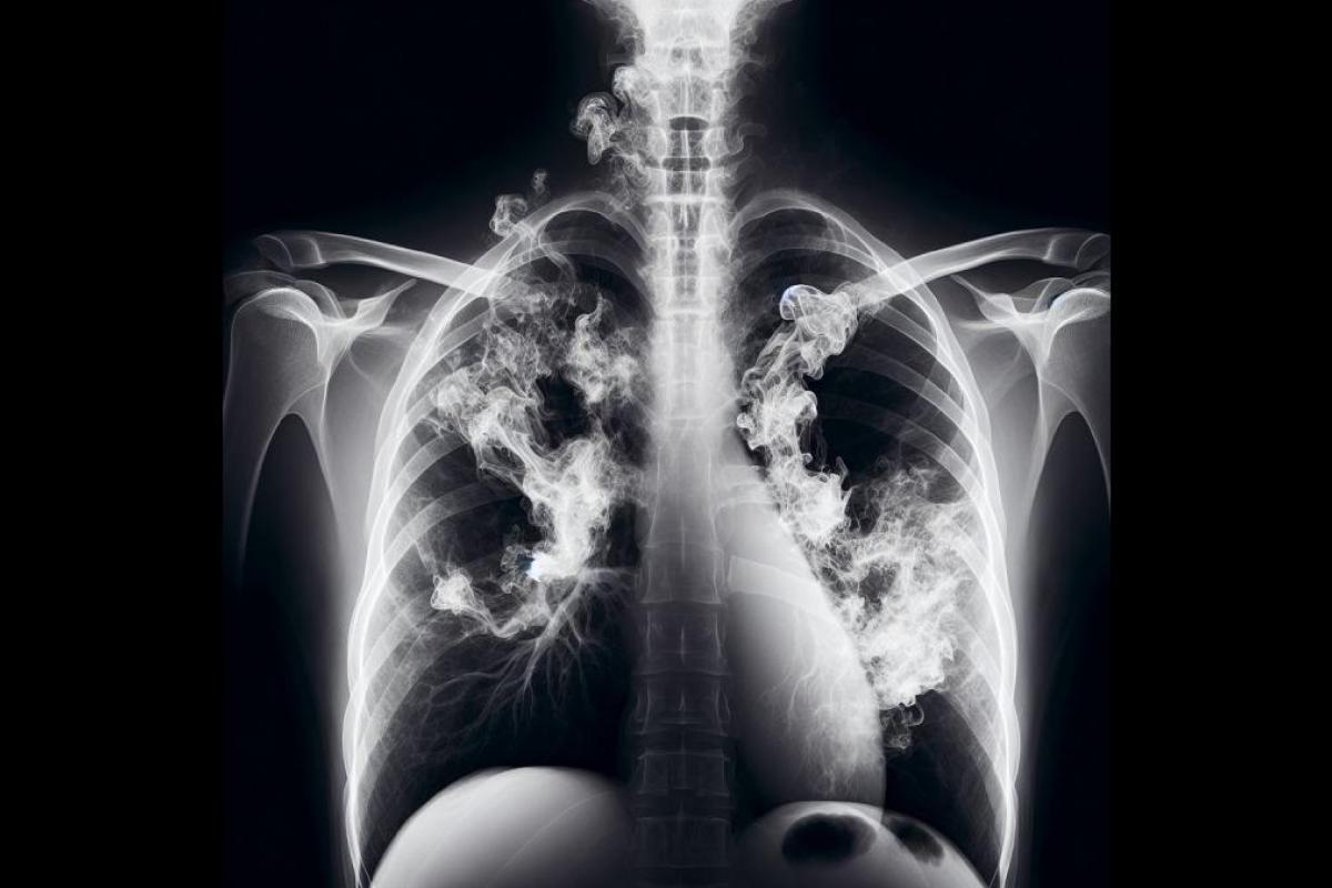 Imagen conceptual de humo en unos pulmones.