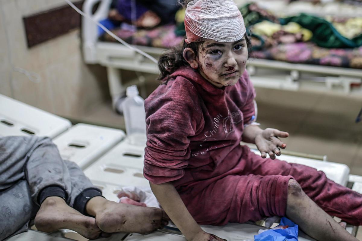 Una niña herida, en el hospital gazatí al que han trasladado a los heridos tras el bombardeo israelí en el campo de refugiados de Nuseirat.