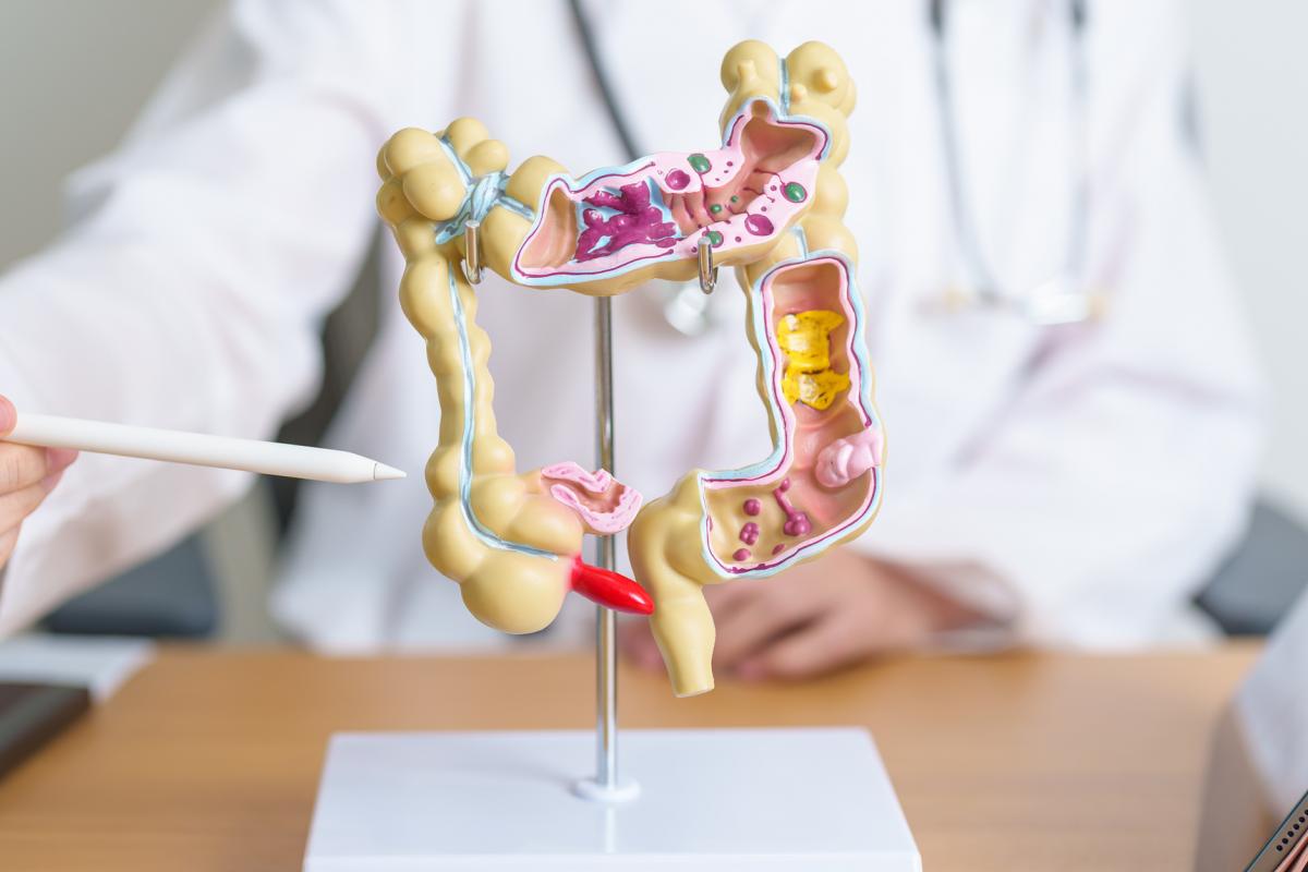 Un médico muestra la anatomía del colon.