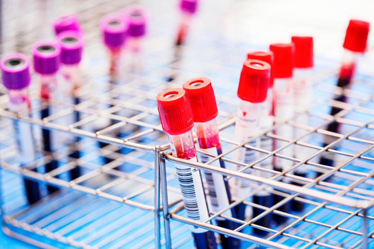 Imagen de archivo de unas muestras de sangre.