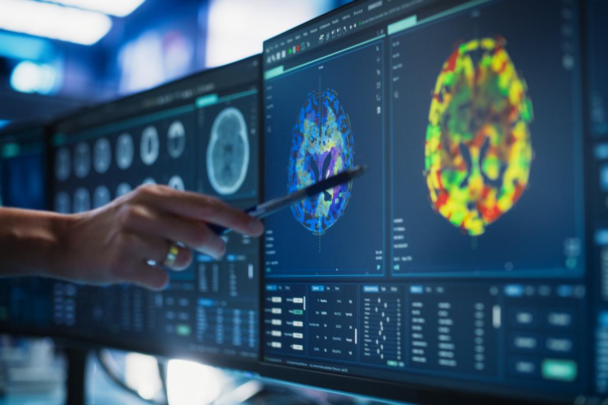 Un especialista analiza un escáner cerebral, en una imagen de recurso