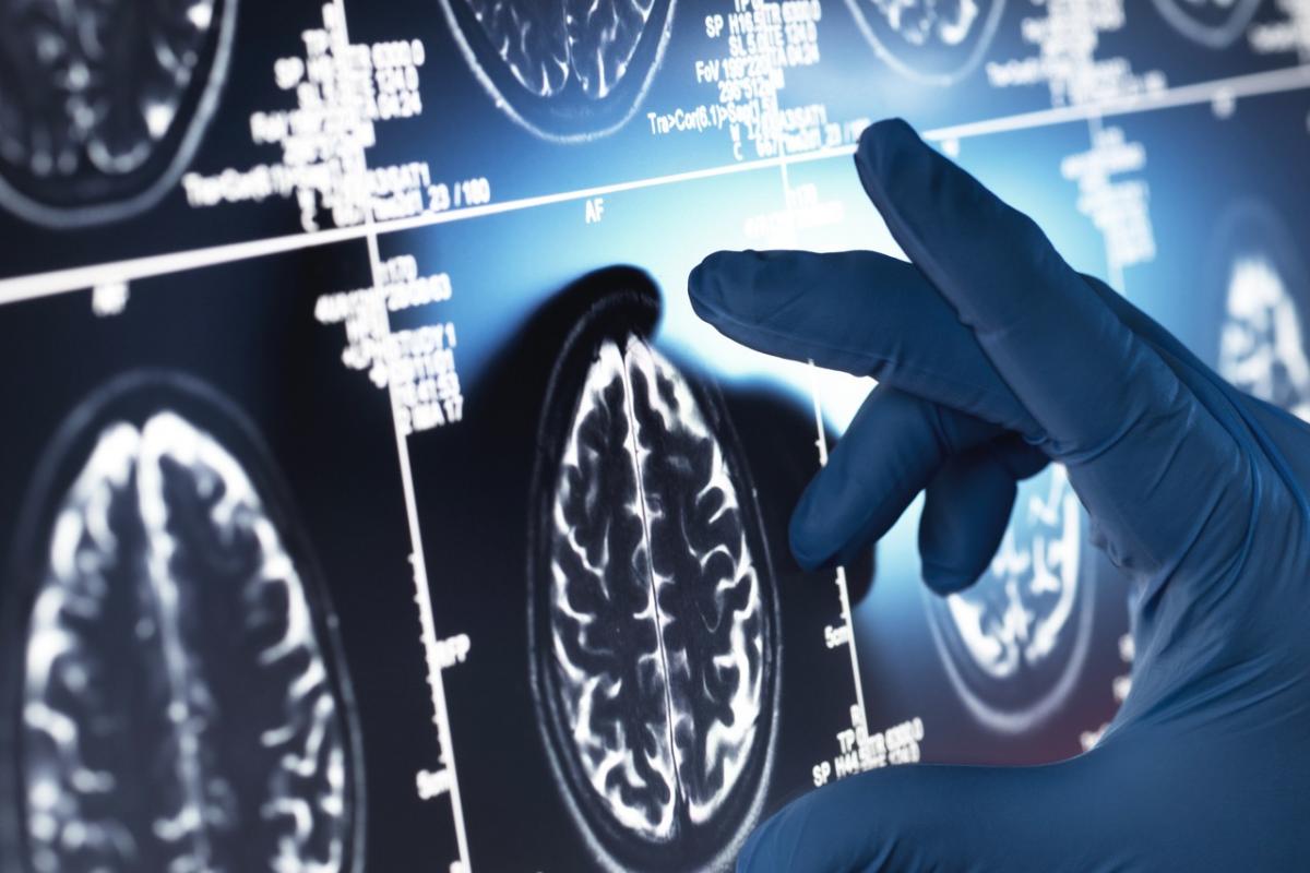 Un profesional analiza los resultados de una tomografía, fundamental para el diagnóstico y el estudio de enfermedades neurológicas como el Alzheimer.