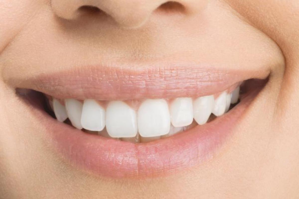 Cómo quitar el sarro con este irrigador dental de Amazon