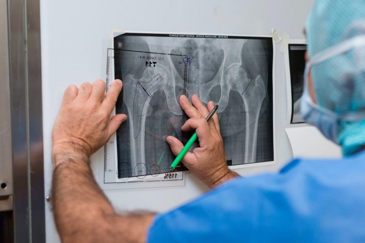Una radiografía de cadera, en una imagen de archivo