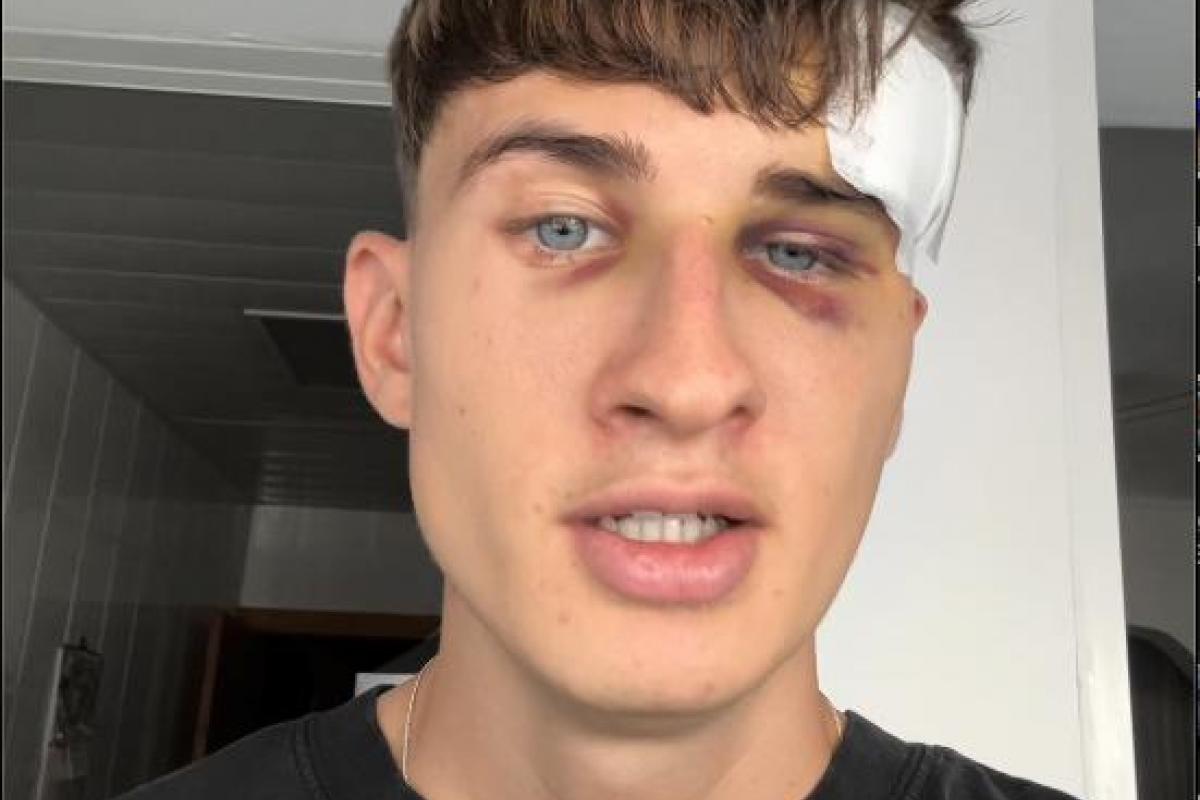 Erik Sanchezz, en su vídeo de TikTok sobre su primera vez en San Fermín.