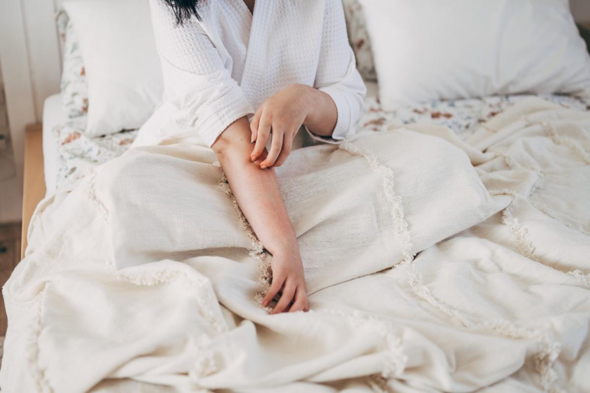 Una mujer se rasca el brazo tras una picadura de mosquito, una de las molestias más comunes del verano.