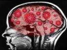 ¿COVID en el cerebro?