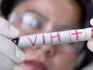 Inmunoterapia experimental o trasplantes de células madre, distintas vías contra el VIH