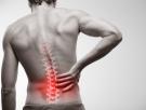 Cinco cosas que debería saber sobre el dolor de espalda
