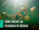 Cómo tratar las picaduras de medusa