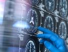 José López Barneo, catedrático de Fisiología y pionero en la investigación de las células madre: "Si todos viviéramos 120 o 130 años, acabaríamos con alzhéimer y Parkinson. El cerebro no puede regenerarse"