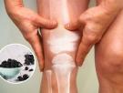 Los expertos en salud ósea coinciden: comer cinco ciruelas pasas al día puede compensar la pérdida ósea de la menopausia