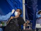Un hombre de 73 años se contagió de hantavirus y coronavirus al mismo tiempo y sobrevivió: estos fueron sus síntomas y el tratamiento recibido