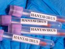 Así se ha disparado el interés por el hantavirus en todo el mundo, según las búsquedas en Google