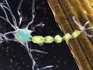 Un paciente paralizado por ELA vuelve a hablar con su familia gracias a un implante cerebral