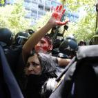 Una mujer herida tras las cargas policiales en el Paseo de la Castellana.