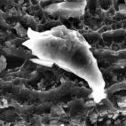 Fractura de aluminio FEI