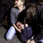 Uno de los heridos durante la protesta