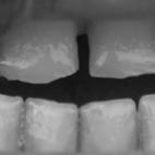 Dice Sierra en su web: "se fotografiaron los dientes de las últimas dos familias de gitanos de la zona. Días después sus viviendas fueron quemadas. Ya no quedan gitanos allí".