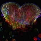 5c8b80cd2000009e0470edc9